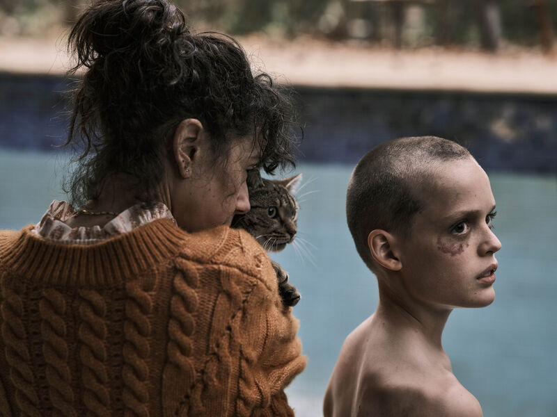 A woman holds a cat next a child with a shaved head and a bruise on their eye.